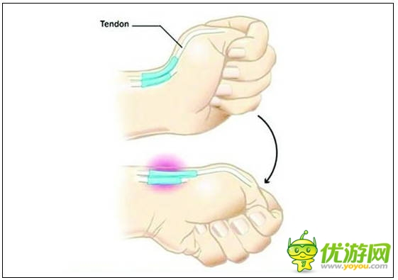 玩手机易患十大“智能手机病” 这些症状你都有吗？